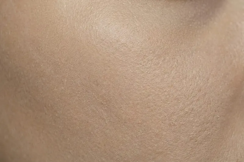 Close-up of skin showing dullness