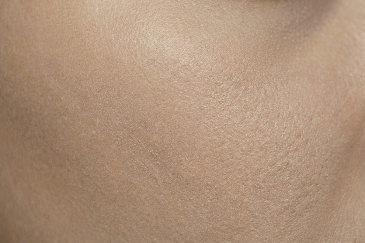 Close-up of skin showing dullness