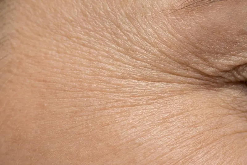 Close-up of skin showing fine lines & wrinkles