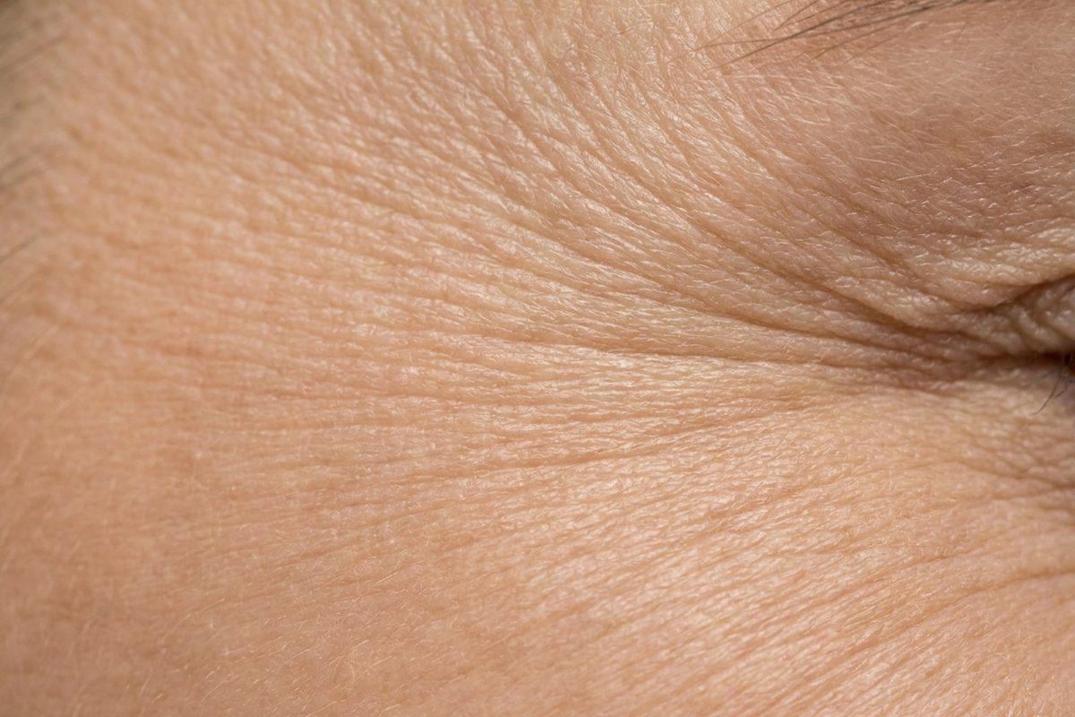 Close-up of skin showing fine lines & wrinkles
