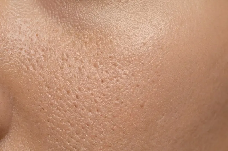 Close-up of skin showing pores