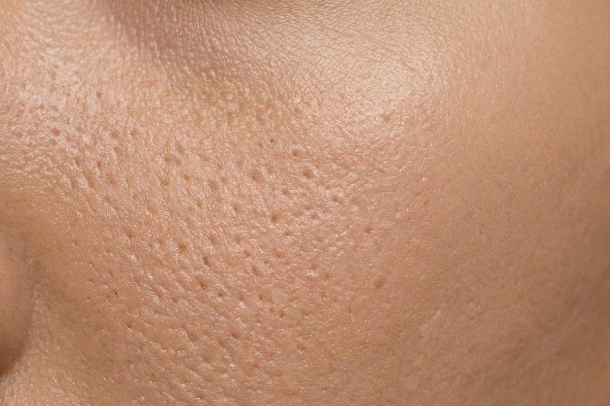 Close-up of skin showing pores